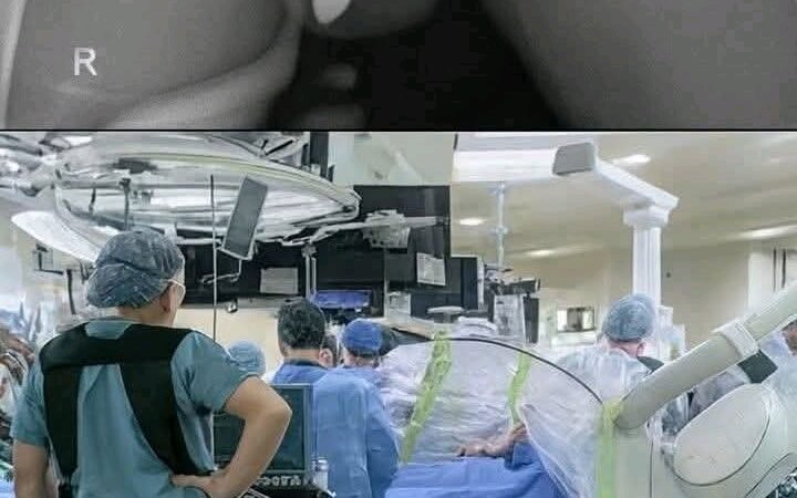 Joven es hospitalizada luego de introducirse un… Ver más