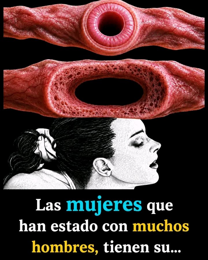 Esto es algo que se debe saber. Se les pone la…Ver más